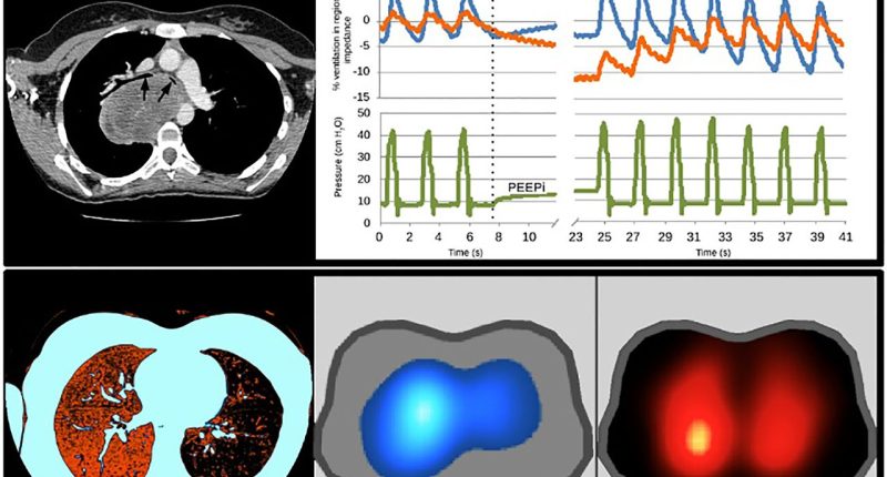 The Basics of Impedance Tomography